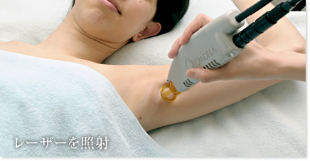 レーザーを照射